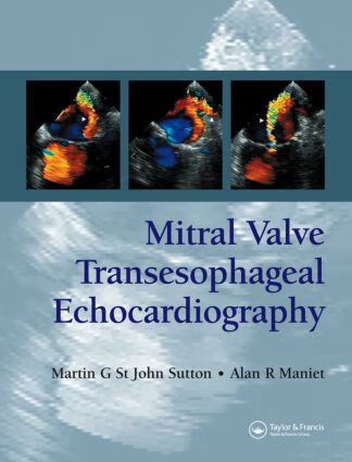 预订 mitral valve transesophageal echocardiography