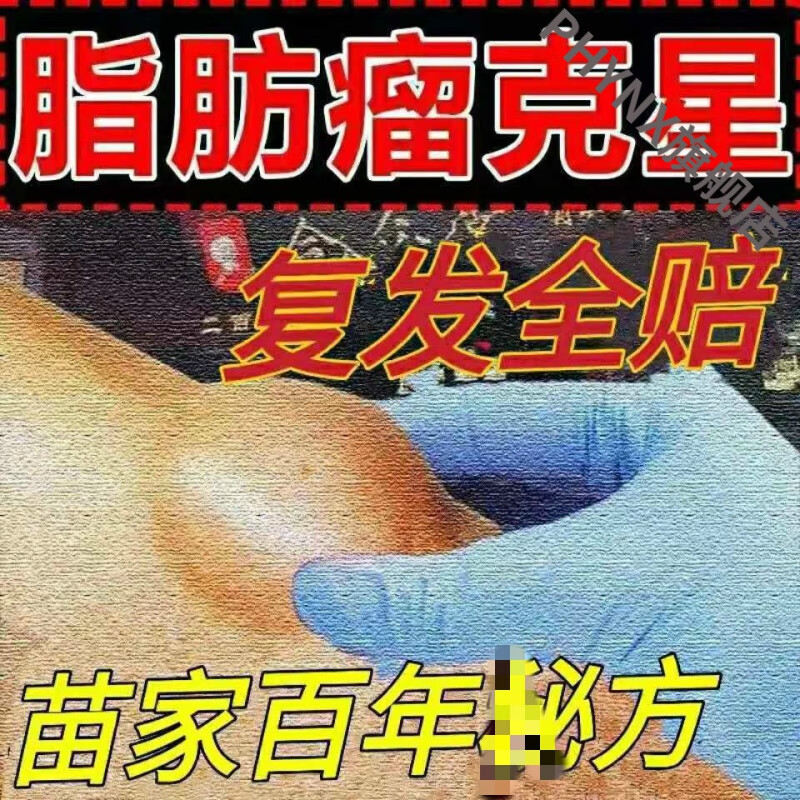 【脂肪瘤不用开刀】脂肪瘤克星去除皮下硬块凸起疙瘩多发性脂肪瘤 1盒