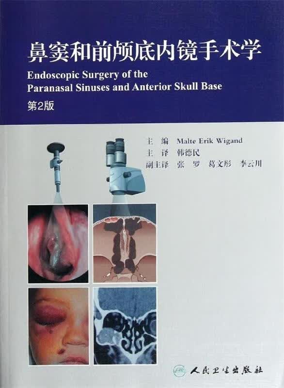 鼻窦和前颅底内镜手术学