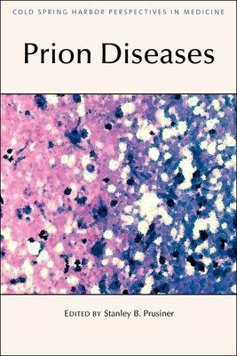 预订prion diseases