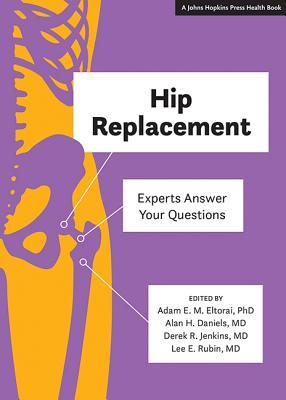 预订hip replacement: experts answer your questions