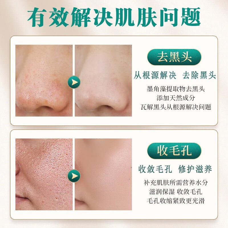南京同仁堂去黑头撕拉面膜去吸鼻贴男女通用收缩毛孔深层清洁面膜祛粉刺死皮鼻80g 一瓶装80g大容量【针对毛孔黑头见效装】