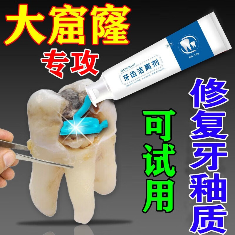 牙釉质修复牙膏损伤蛀牙洞修复龋齿牙洞清理缓解牙齿敏感虫牙去口臭口腔护理抑菌牙膏 买②送①【大多数人的选择】