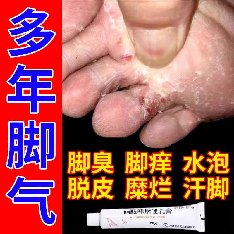 脚气药止痒脱皮烂脚丫真菌感染止痒硝酸咪康唑乳膏脚气