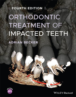 预订 orthodontic treatment of impacted teeth 4/e