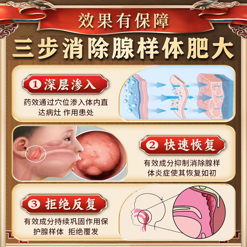 腺样体肥大中药贴儿童用药嘴突鼻塞张嘴呼吸睡觉打鼾面容矫正器 【升级版】一盒【多买多送】