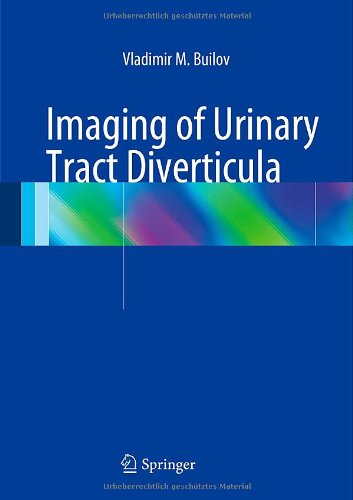 预订 imaging of urinary tract diverticula