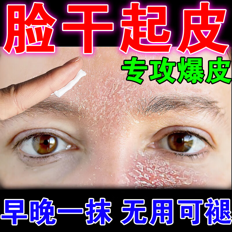 干燥起皮女男士脸部过敏泛红脱卸补水下巴额头脸上长癣温和保湿软膏 1