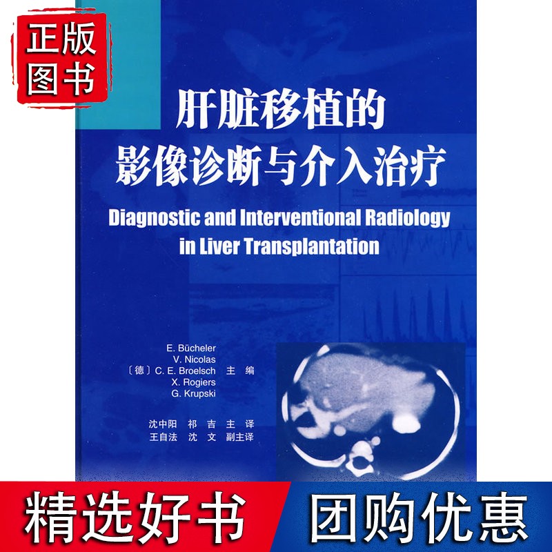 肝脏移植的影像诊断与介入治疗