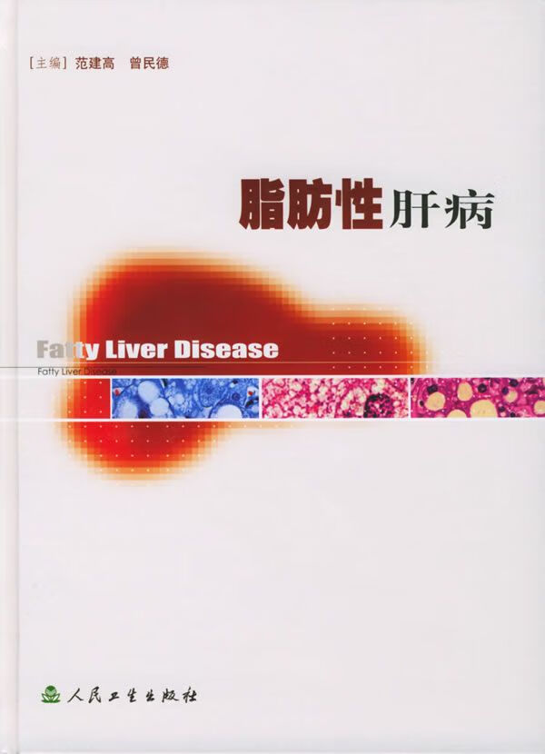 脂肪性肝病