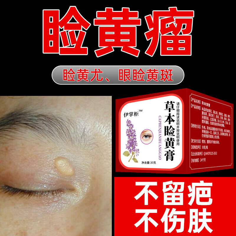 【旗舰优选】 治眼睑黄瘤【无痛去睑黄瘤】去除睑黄疣脸黄瘤眼部眼睑