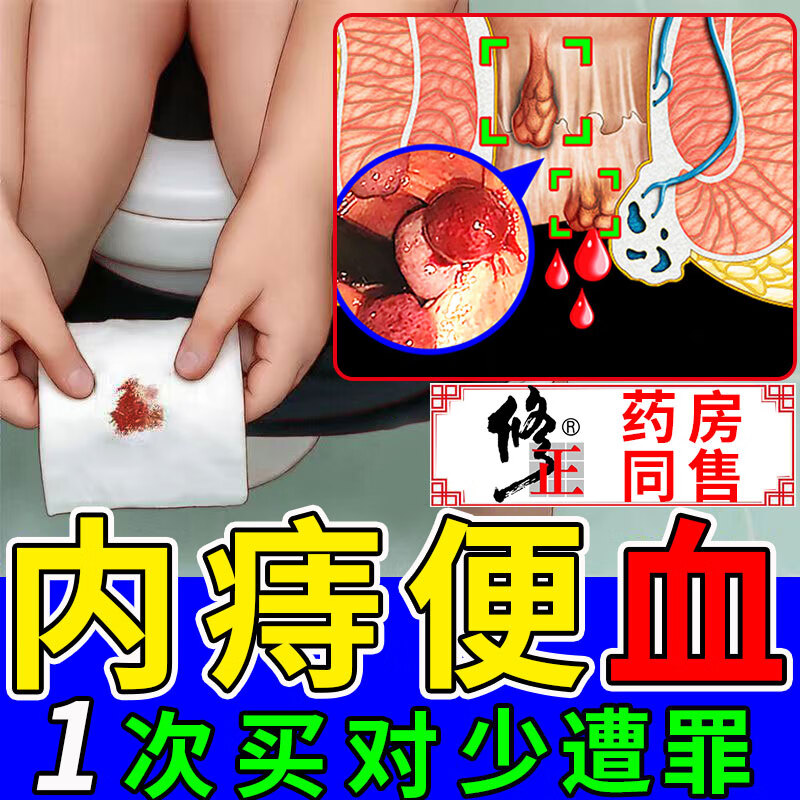 内痔疮大便喷血特傚效有药监备案痔疮便血专用流血内痣便血大便出血