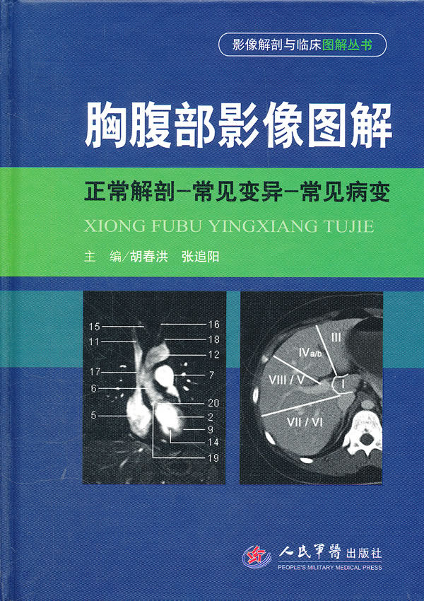 胸腹部影像图解【稀缺图书,放心购买】