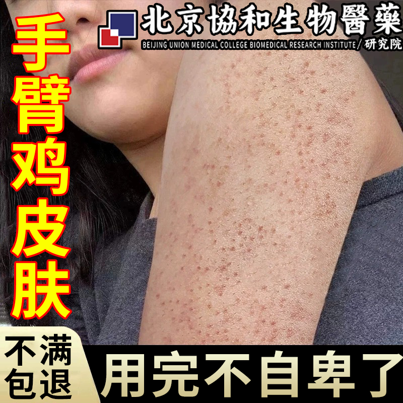 京东官方旗舰店自营手臂鸡皮肤疙瘩毛囊角化症专用毛囊炎沐浴露去鸡皮