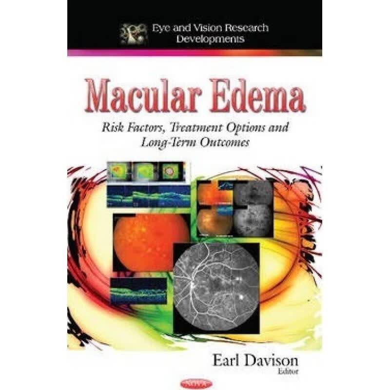 预订 Macular Edema: Risk Factors, Treatment Optio...