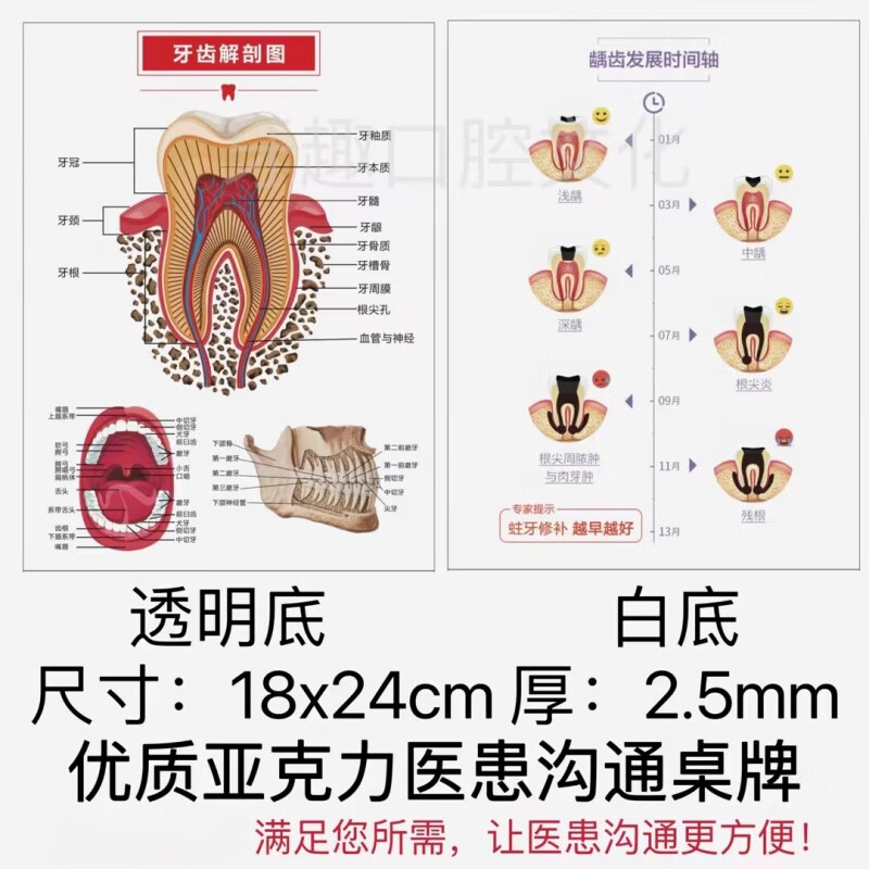牙科医患沟通牙模型工具根管治疗窝沟封闭流程种植牙模型沟通 龋齿
