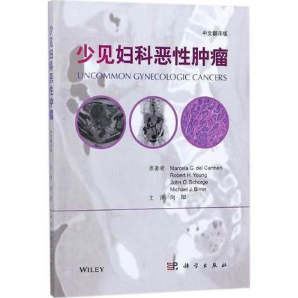 少见妇科恶性肿瘤_向阳主译