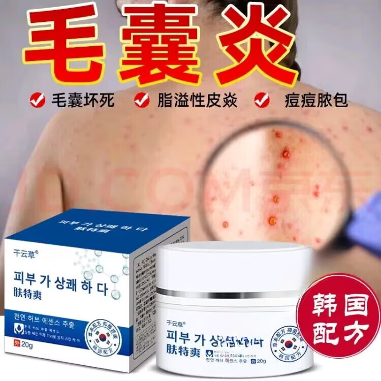 千云草【韩国进口祛痘膏】毛囊炎皮肤瘙痒头皮毛囊炎脂溢性皮l炎头部