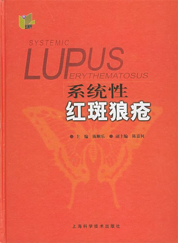 系统性红斑狼疮
