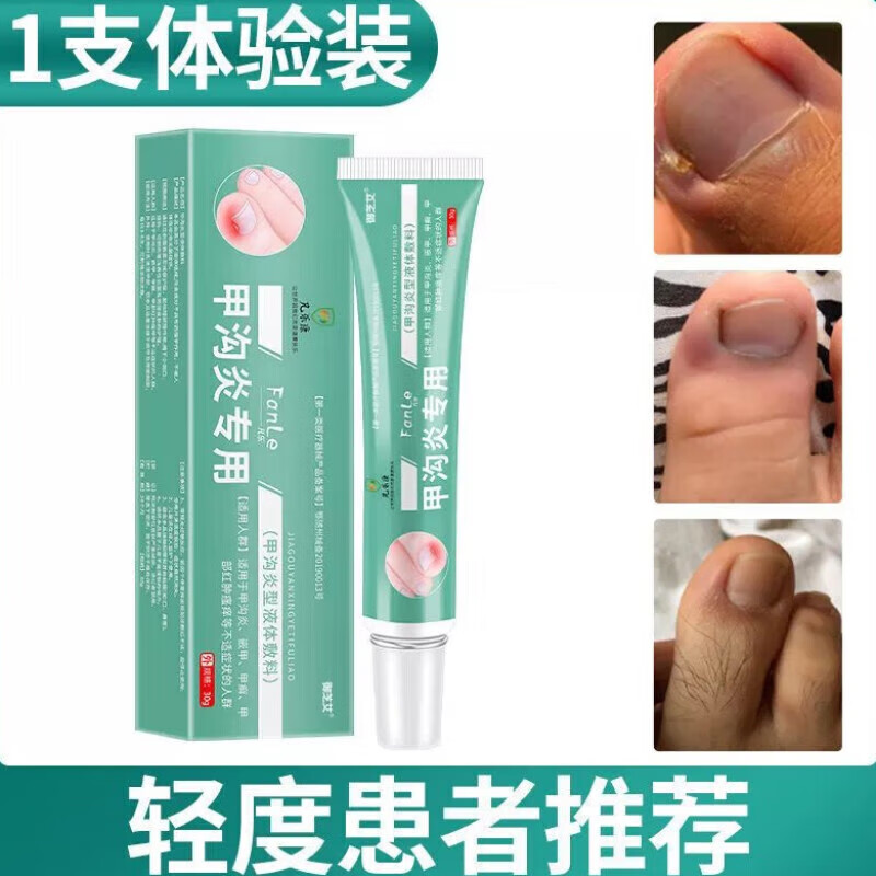 手指甲沟炎专用软化剂药软甲发炎红肿化脓扎嵌甲器脚趾甲专用 一盒