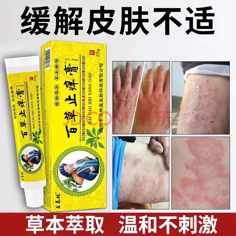 王泰林百草痒膏皮肤瘙痒干燥干痒湿l疹皮l炎大腿内侧湿痒难耐 买3+2【五盒巩固装】