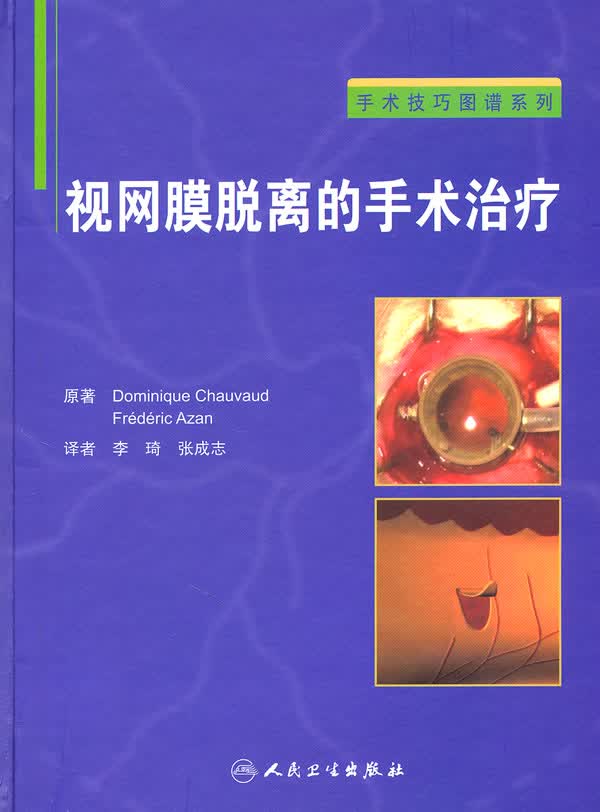 视网膜脱离的手术治疗【正版图书】