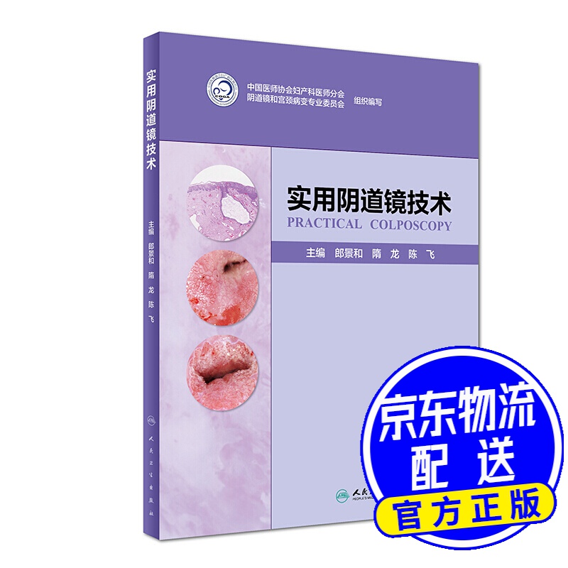 实用阴道镜技术