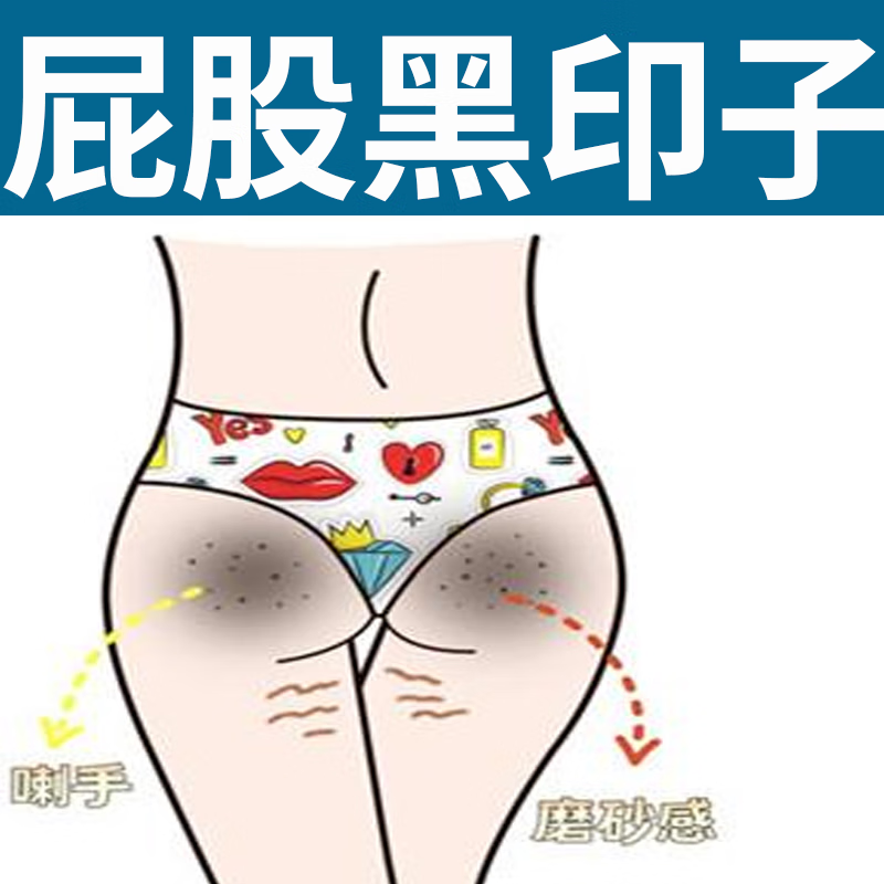 卡地纳【屁股黑印】屁股下边黑臀部黑色素沉淀久坐屁股黑皮肤粗糙 屁股黑印[大面积]:5盒装