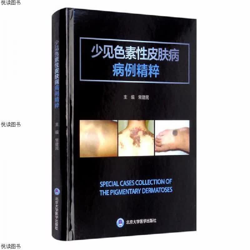 少见色素性皮肤病病例精粹