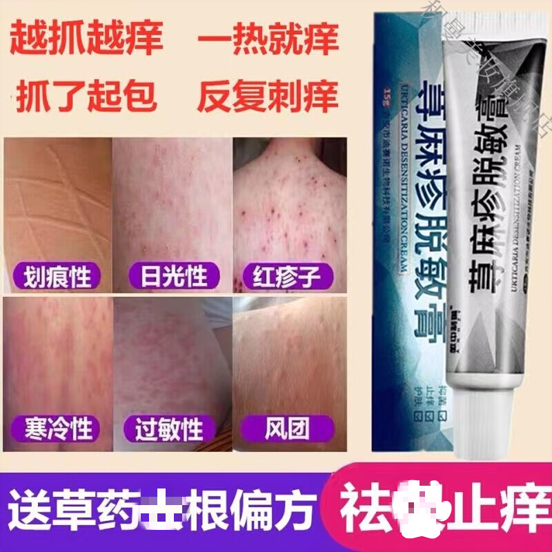 急慢性荨麻l疹段跟皮l炎湿l疹真菌感染风团划痕过敏皮肤痒瘙抑菌箹l膏