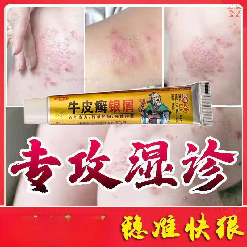 银屑灵i膏 皮肤外用湿疹改善手足廯牛皮藓银屑皮肤瘙痒膏牛皮头皮