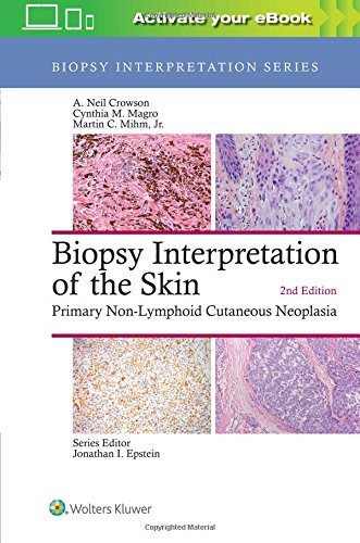 预订 biopsy interpretation of the skin (biopsy interpretation