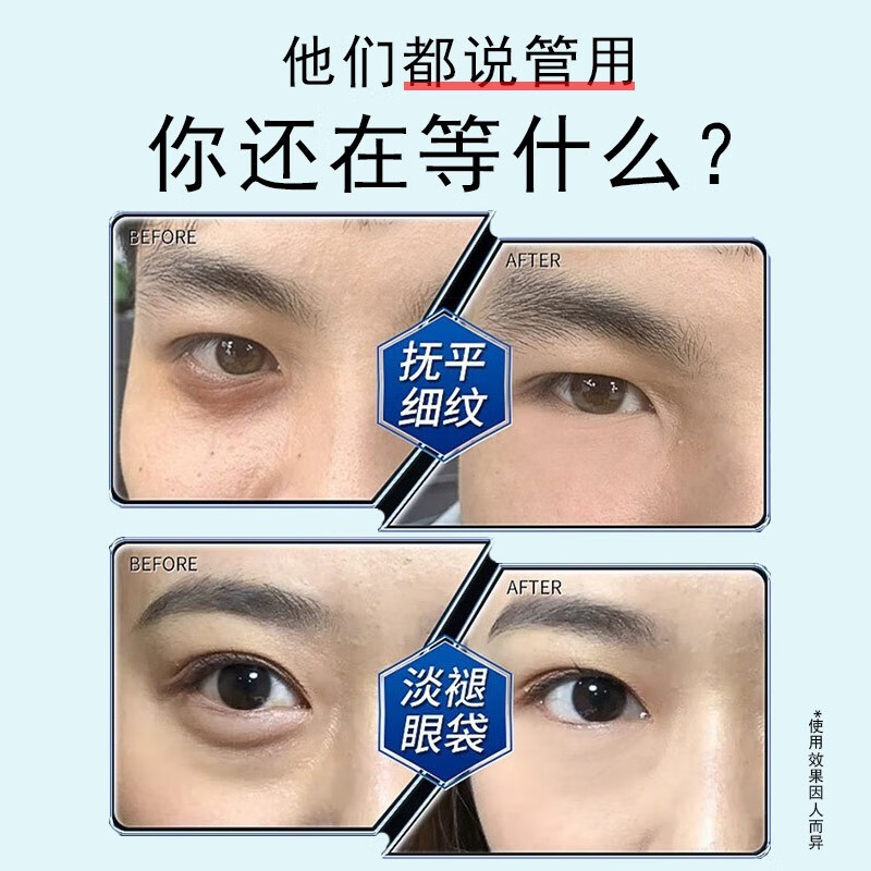 美颜坊国药集团天目湖多效舒润眼霜男士专用淡化细纹提拉紧致黑眼圈眼袋 【第2支10】消去抗皱眼霜大品牌
