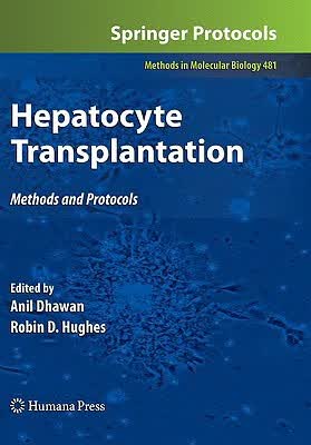 预订 Hepatocyte Transplantation