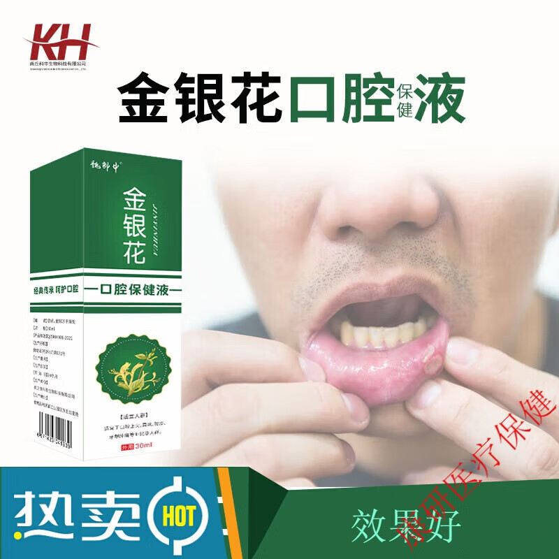 口腔溃疡喷剂牙龈肿痛口气口臭清新喷雾本草金银花口喷剂 单盒装