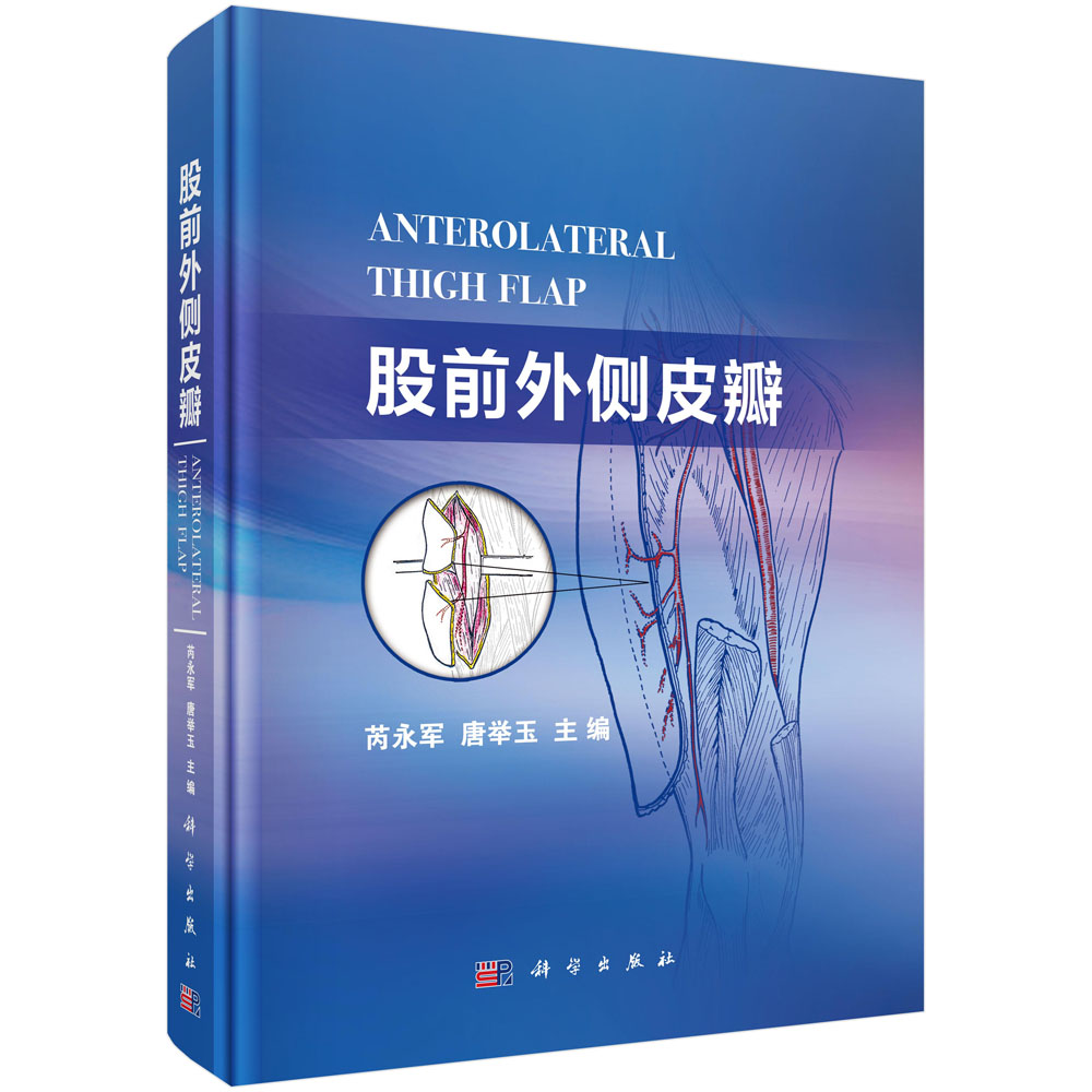 股前外侧皮瓣
