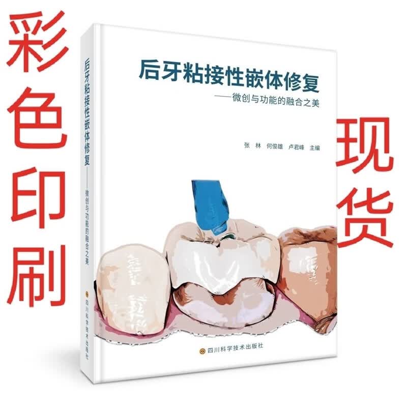 高清彩色 后牙粘接性嵌体修复 微创与功能的融合之美口腔修复补牙 腔修复补牙