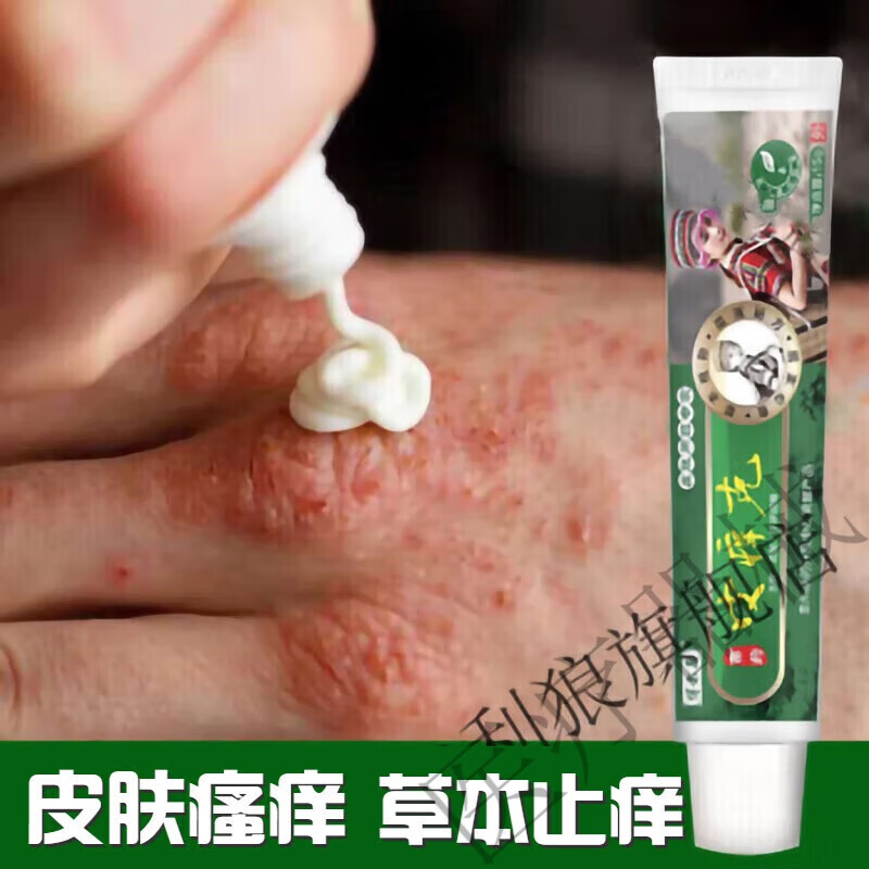 皮痒克痒止膏皮肤瘙痒皮l炎疹湿牛癣皮银l屑老年人身痒上 一支体验装