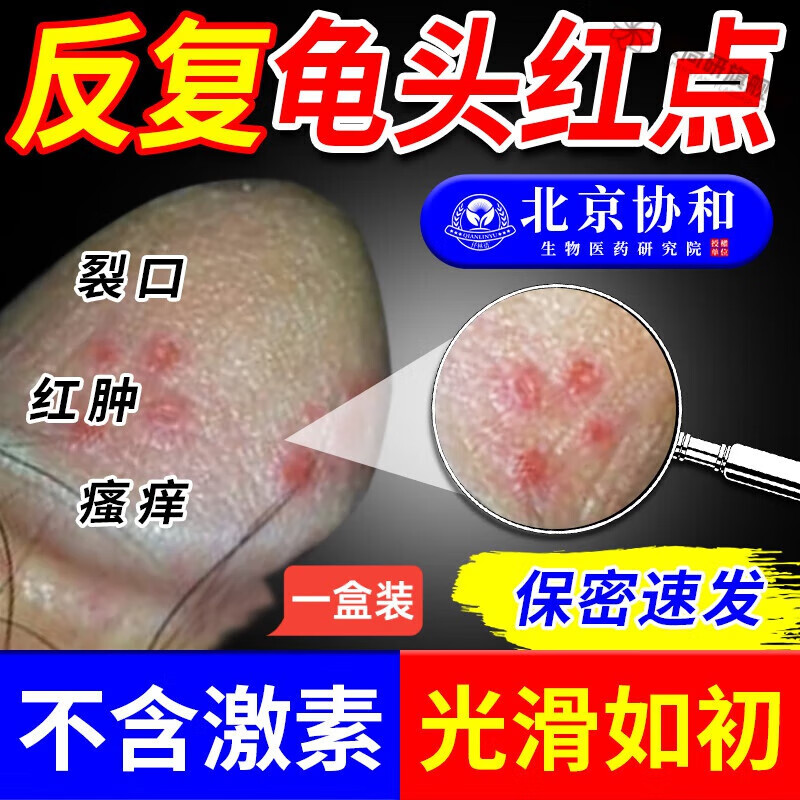 龟头上有小红点红肿脱皮粘膜裂口包皮白垢真菌感染药监备案sc 一盒装