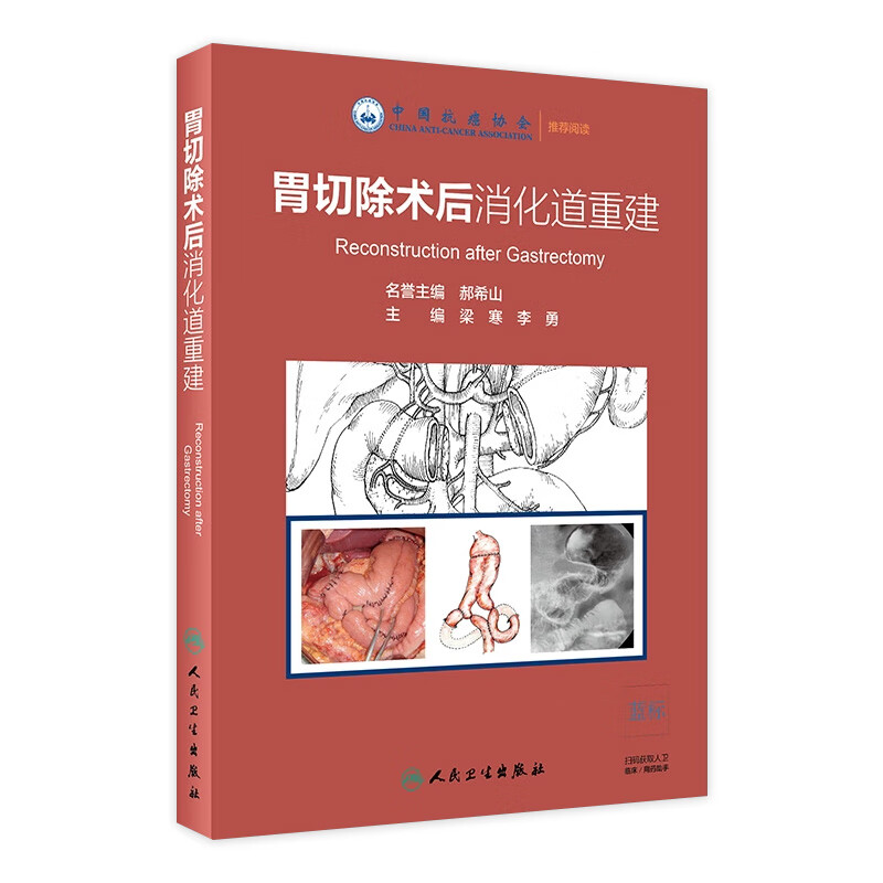 胃切除术后消化道重建 梁寒 李勇 主编 外科学 9787117279079 20