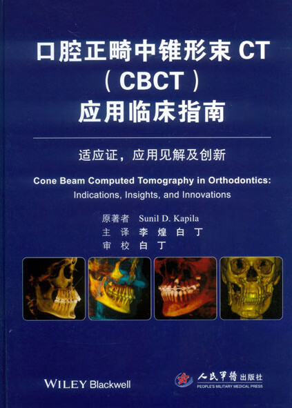 口腔正畸中锥形束ct(cbct)应用临床指南.适应证,应用见解及创新