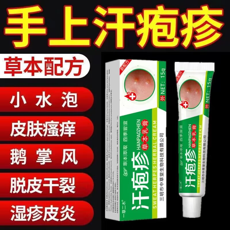 一草二木汗l疱l疹手上起小水泡手痒手脚脱皮干裂手足l藓真菌感染 买3+2【五盒巩固装】