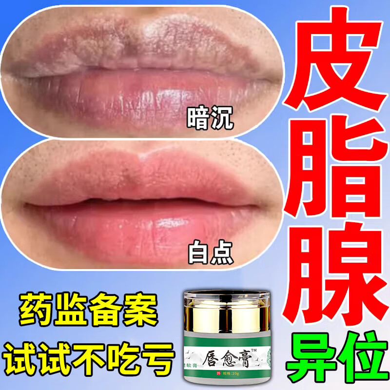 皮脂腺异位症去除嘴唇疱疹白点增生脂肪小颗粒口角炎唇炎上火脱皮 单