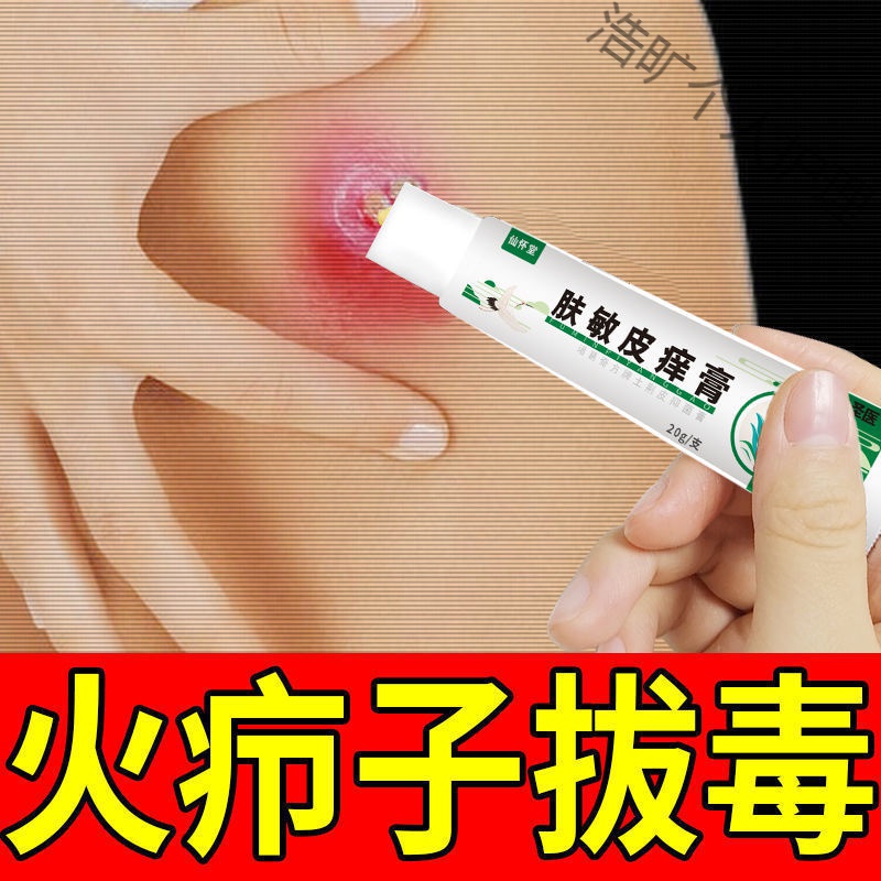火疖子拔i毒膏屁股疙瘩脓包流脓坐板疮毒痘痘流脓痒疼痛消红肿疙瘩 三