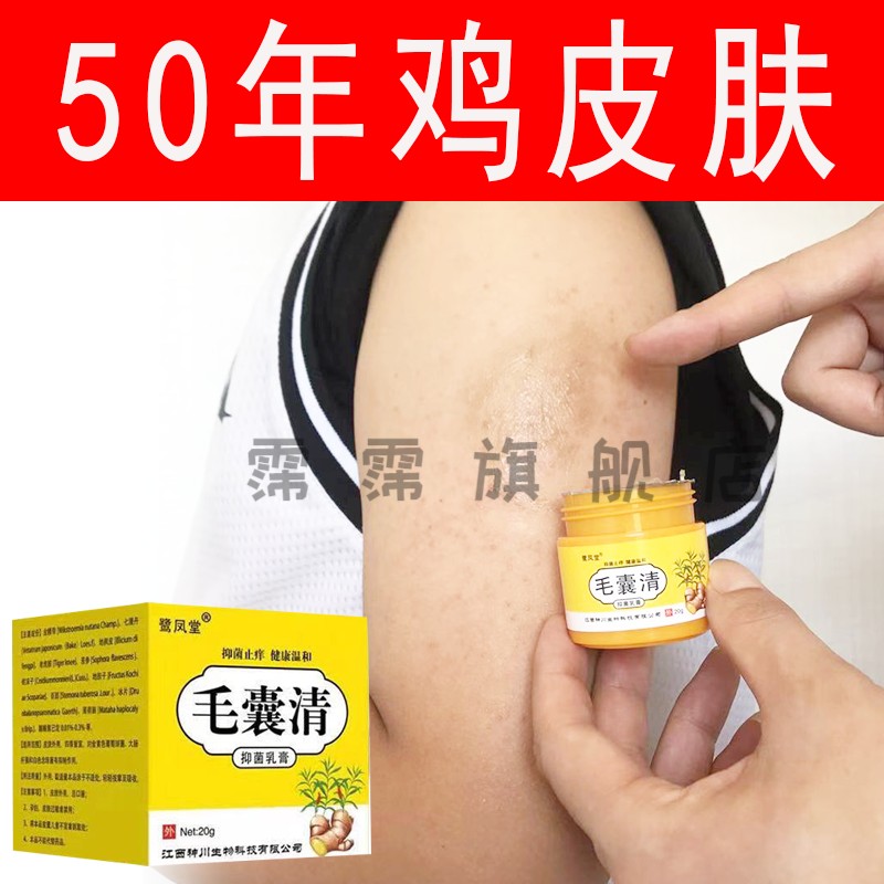 中年大面积鸡皮肤(鸡皮肤最严重的年龄) 中年大面积鸡皮肤(鸡皮肤最严重的年龄)