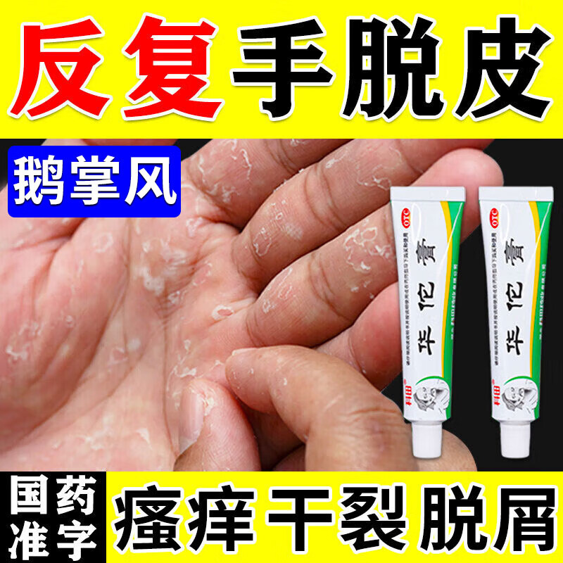 治鹅掌风药膏 手癣专用药膏 手脱皮开裂真菌感染手上起小水泡手指缝痒