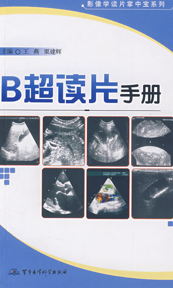 B超读片手册——影像学读片掌中宝系列 王燕,栗建辉 主【放心选购】