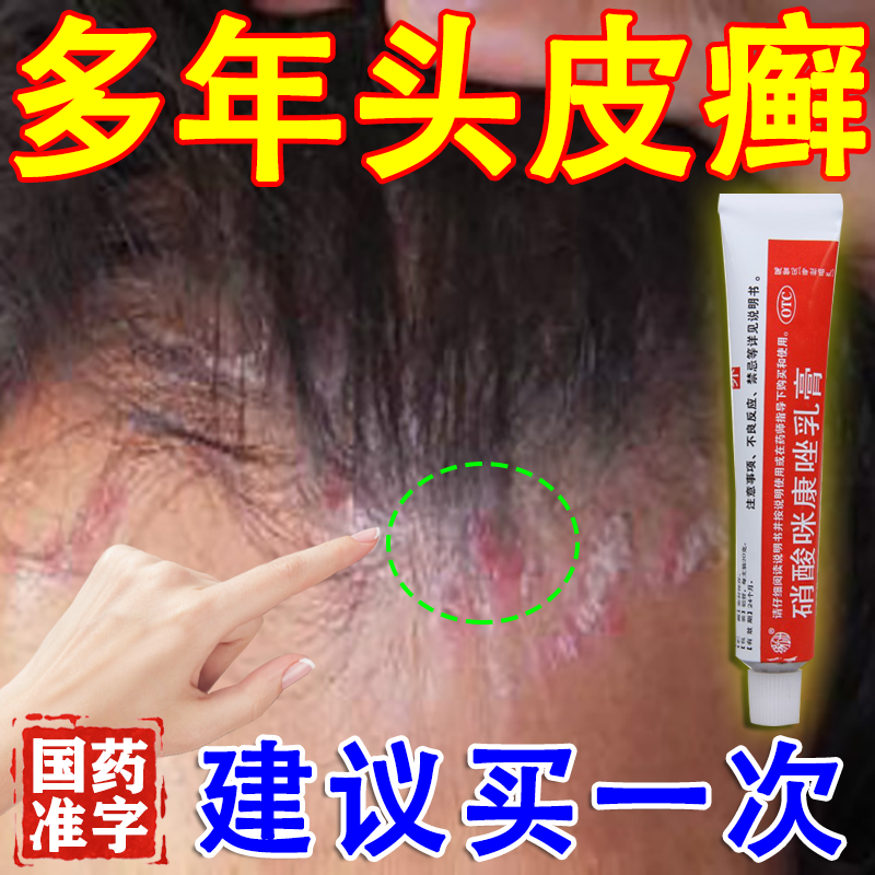 头屑头痒头皮癣专用药膏】硝酸咪康唑乳膏 脂溢性皮炎头皮红斑瘙痒