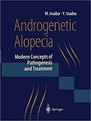 预订 androgenetic alopecia