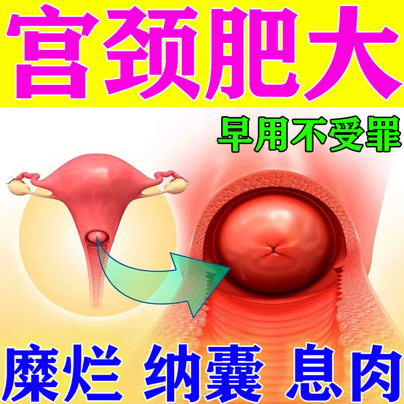 宫颈肥大囊肿慢性盆腔i炎宫颈息肉糜烂子宫脱落盆腔内膜厚月经不调